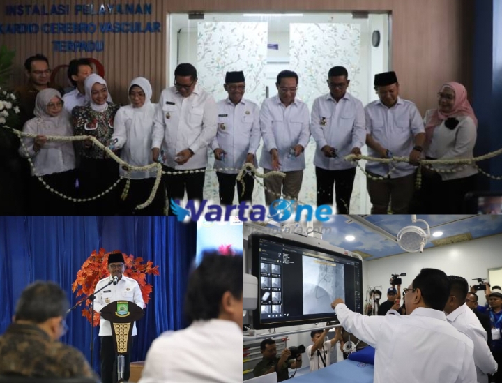 Layanan Jantung dan Stroke Gratis BPJS, Wamenkes: Cath Lab RSUD Kota Tangerang Setara RS Rujukan Nasional